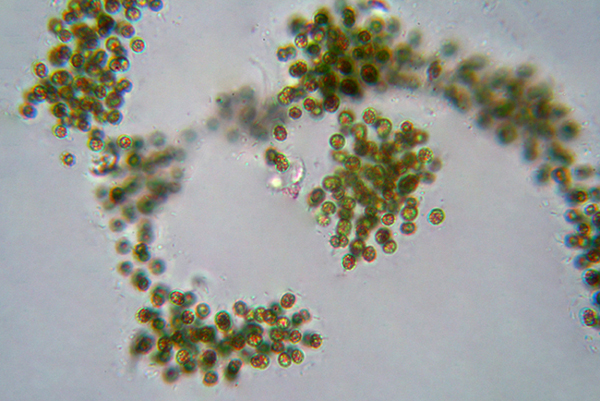 Acqua melmosa - Microcystis?